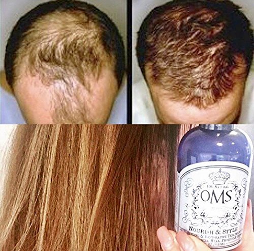 hair growth oil curly products keratin treatment serum care for women styling dry damaged and anti frizz stuff thickening wavy control frizzy moisturizer gloss oils regrowth loss treatments repair natural method treated moisturizing beauty amazing