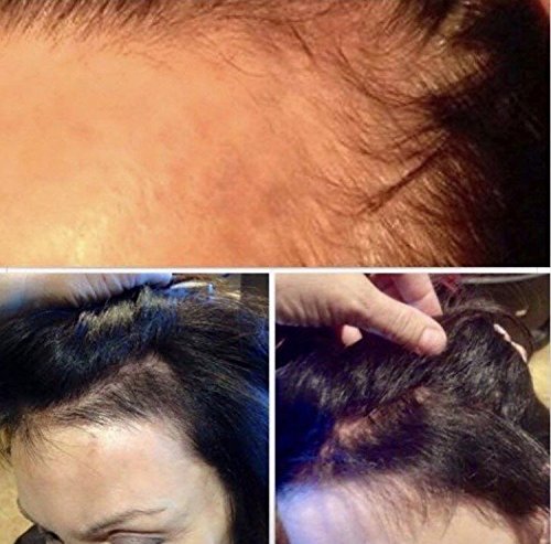 hair treatment oils
