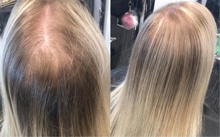 hair repair treatment for damaged hair